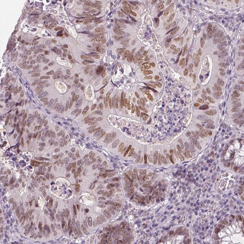 Lysine (K)-specific Demethylase 5B/KDM5B/JARID1B Antibody (CL1129) - Azide and BSA Free Immunohistochemistry-Paraffin: Lysine (K)-specific Demethylase 5B/KDM5B/JARID1B Antibody [NBP3-43901]