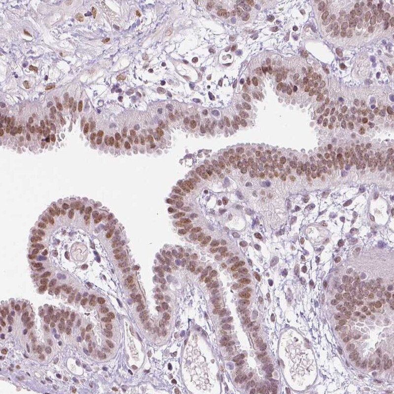 Lysine (K)-specific Demethylase 5B/KDM5B/JARID1B Antibody (CL1129) - Azide and BSA Free Immunohistochemistry-Paraffin: Lysine (K)-specific Demethylase 5B/KDM5B/JARID1B Antibody [NBP3-43901]