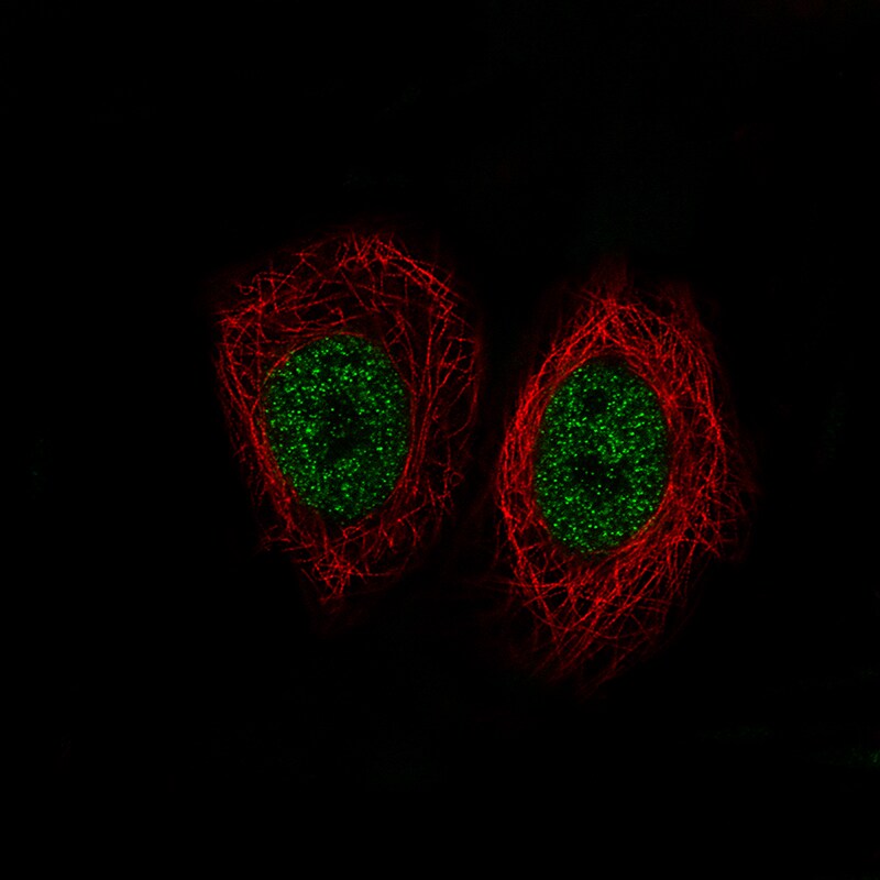 Lysine (K)-specific Demethylase 5B/KDM5B/JARID1B Antibody (CL1129) - Azide and BSA Free Immunocytochemistry/ Immunofluorescence: Lysine (K)-specific Demethylase 5B/KDM5B/JARID1B Antibody [NBP3-43901]
