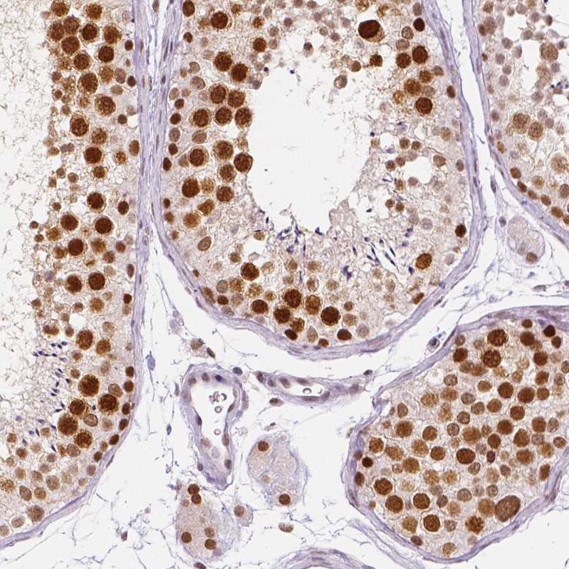 Lysine (K)-specific Demethylase 5B/KDM5B/JARID1B Antibody (CL1129) - Azide and BSA Free Immunohistochemistry-Paraffin: Lysine (K)-specific Demethylase 5B/KDM5B/JARID1B Antibody [NBP3-43901]
