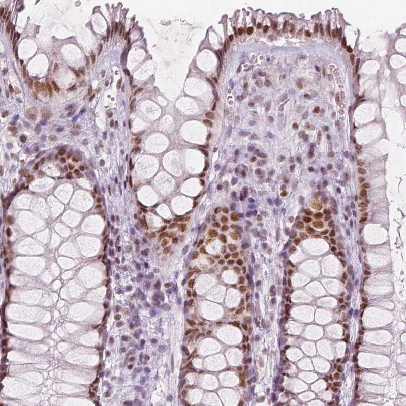 Lysine (K)-specific Demethylase 5B/KDM5B/JARID1B Antibody (CL1129) - Azide and BSA Free Immunohistochemistry-Paraffin: Lysine (K)-specific Demethylase 5B/KDM5B/JARID1B Antibody [NBP3-43901]