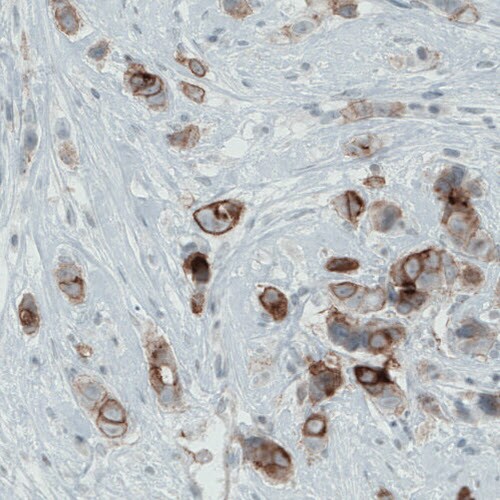 Occludin Antibody (CL1567) - Azide and BSA Free Immunohistochemistry-Paraffin: Occludin Antibody [NBP3-43903]