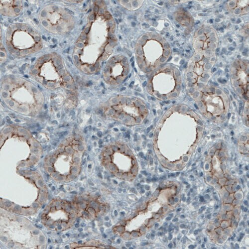 Occludin Antibody (CL1567) - Azide and BSA Free Immunohistochemistry-Paraffin: Occludin Antibody [NBP3-43903]
