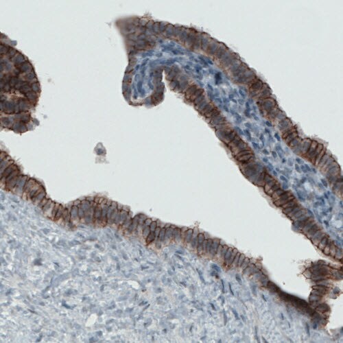 Occludin Antibody (CL1567) - Azide and BSA Free Immunohistochemistry-Paraffin: Occludin Antibody [NBP3-43903]