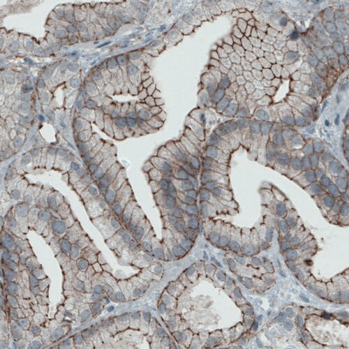 Occludin Antibody (CL1567) - Azide and BSA Free Immunohistochemistry-Paraffin: Occludin Antibody [NBP3-43903]
