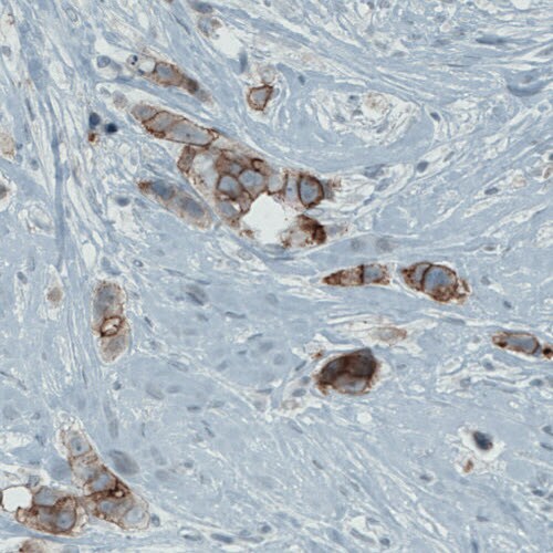 Occludin Antibody (CL1608) - Azide and BSA Free Immunohistochemistry-Paraffin: Occludin Antibody [NBP3-43904]