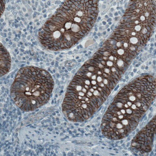 Occludin Antibody (CL1608) - Azide and BSA Free Immunohistochemistry-Paraffin: Occludin Antibody [NBP3-43904]