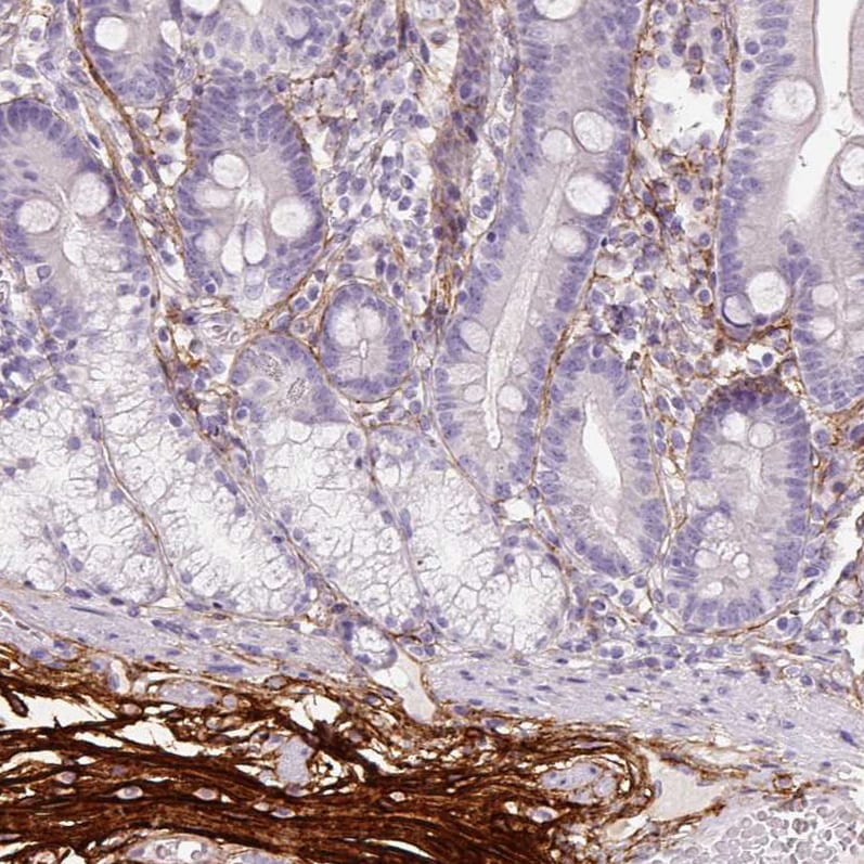 Fibrillin 1 Antibody (CL0225) - Azide and BSA Free Immunohistochemistry-Paraffin: Fibrillin 1 Antibody [NBP3-43905]