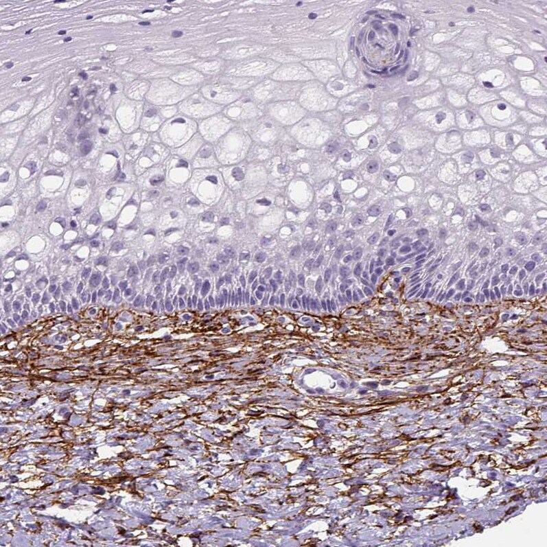 Fibrillin 1 Antibody (CL0225) - Azide and BSA Free Immunohistochemistry-Paraffin: Fibrillin 1 Antibody [NBP3-43905]