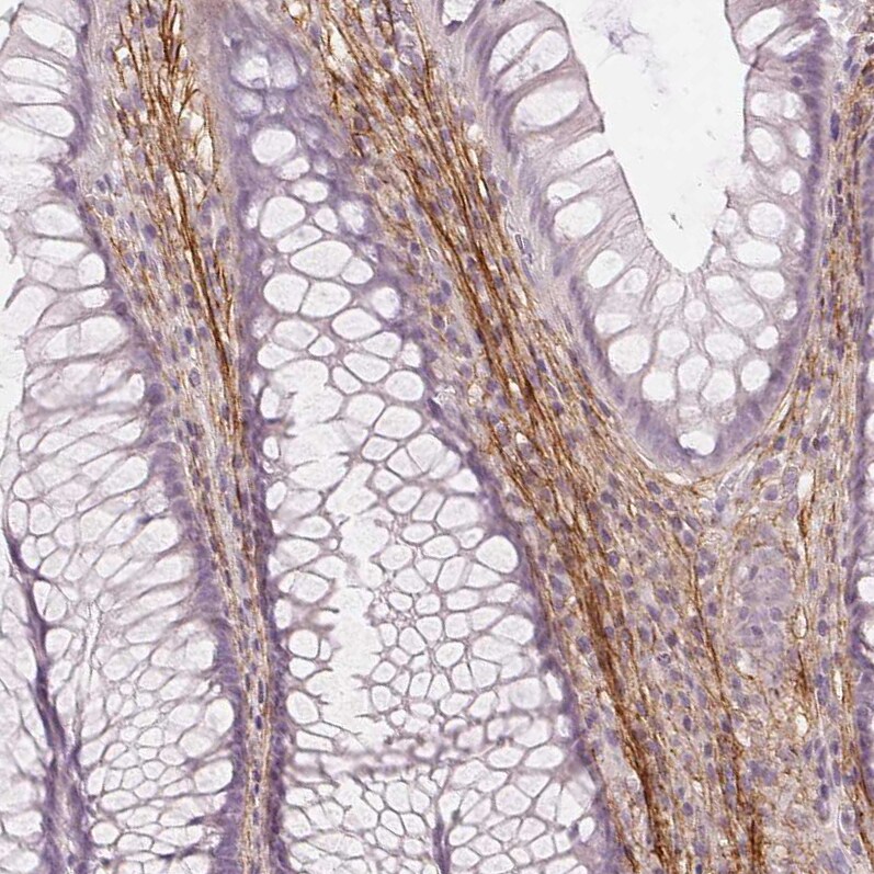 Fibrillin 1 Antibody (CL0226) - Azide and BSA Free Immunohistochemistry-Paraffin: Fibrillin 1 Antibody [NBP3-43906]