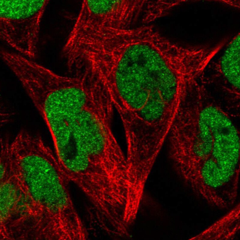 ZEB1 Antibody (CL0151) - Azide and BSA Free Immunocytochemistry/ Immunofluorescence: ZEB1 Antibody [NBP3-43907]