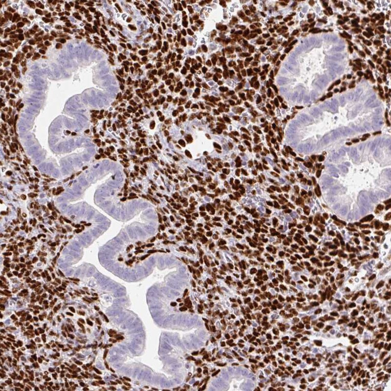 ZEB1 Antibody (CL0151) - Azide and BSA Free Immunohistochemistry-Paraffin: ZEB1 Antibody [NBP3-43907]