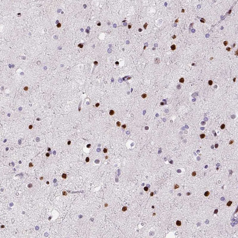 ZEB1 Antibody (CL0151) - Azide and BSA Free Immunohistochemistry-Paraffin: ZEB1 Antibody [NBP3-43907]