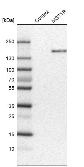 MSPR/Ron Antibody (CL0463) - Azide and BSA Free Western Blot: MSPR/Ron Antibody [NBP3-43908]
