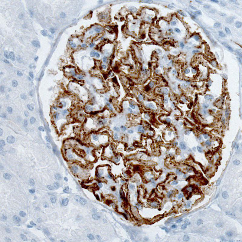 PLA2R1 Antibody (CL0474) - Azide and BSA Free Immunohistochemistry-Paraffin: PLA2R1 Antibody [NBP3-43909]
