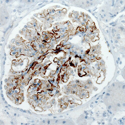 PLA2R1 Antibody (CL0485) - Azide and BSA Free Immunohistochemistry-Paraffin: PLA2R1 Antibody [NBP3-43910]