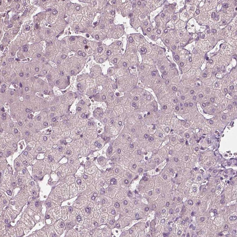 PLA2R1 Antibody (CL0485) - Azide and BSA Free Immunohistochemistry-Paraffin: PLA2R1 Antibody [NBP3-43910]