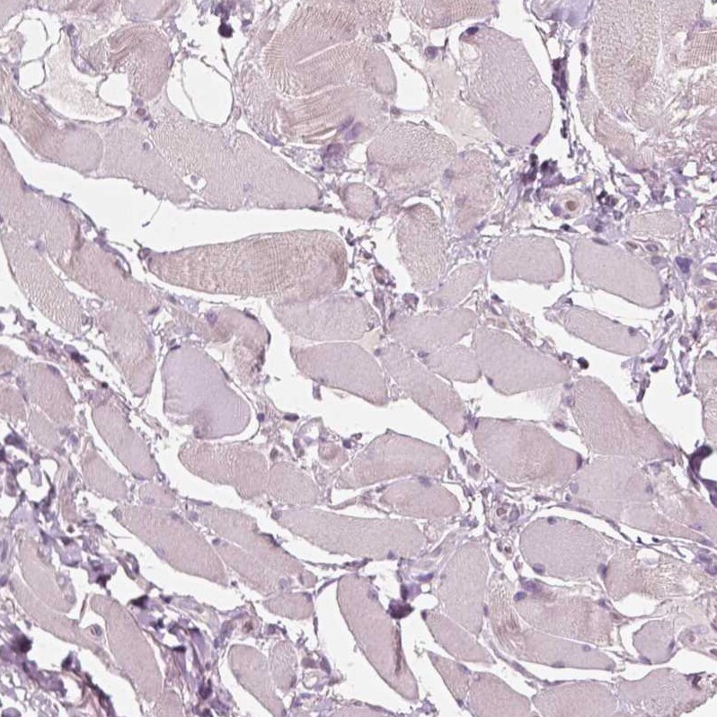 PLA2R1 Antibody (CL0485) - Azide and BSA Free Immunohistochemistry-Paraffin: PLA2R1 Antibody [NBP3-43910]