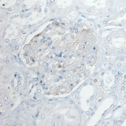 PLA2R1 Antibody (CL0485) - Azide and BSA Free Immunohistochemistry-Paraffin: PLA2R1 Antibody [NBP3-43910]
