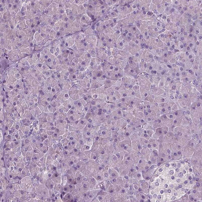 PLA2R1 Antibody (CL0485) - Azide and BSA Free Immunohistochemistry-Paraffin: PLA2R1 Antibody [NBP3-43910]