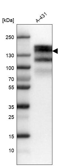 EGFR Antibody (CL0822) - Azide and BSA Free Western Blot: EGFR Antibody [NBP3-43912]