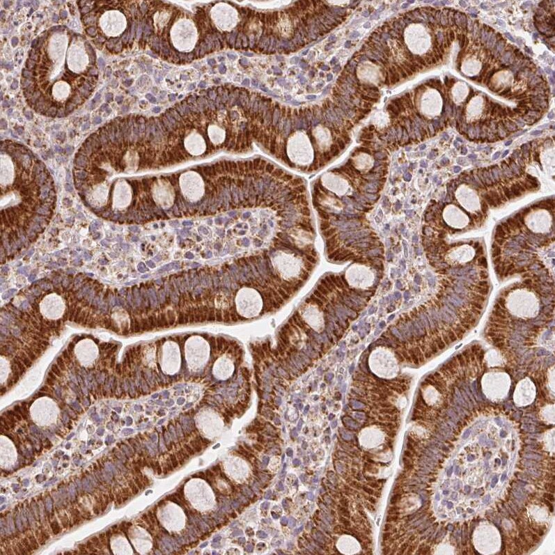 SDHB Antibody (CL0346) - Azide and BSA Free Immunohistochemistry-Paraffin: SDHB Antibody [NBP3-43913]