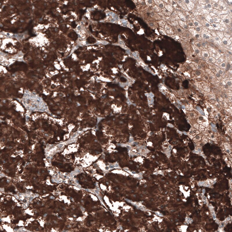 Chromogranin B Antibody (CL11393) - Azide and BSA Free Immunohistochemistry-Paraffin: Chromogranin B Antibody [NBP3-43914]