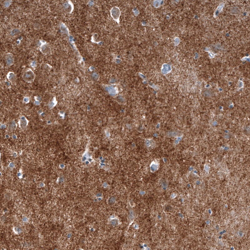 Chromogranin B Antibody (CL11393) - Azide and BSA Free Immunohistochemistry-Paraffin: Chromogranin B Antibody [NBP3-43914]