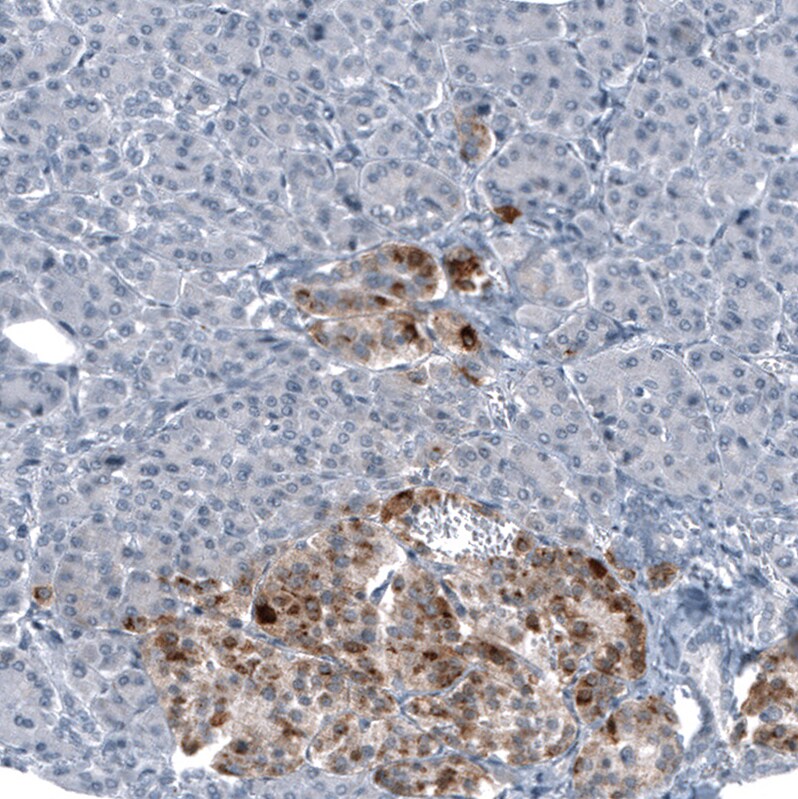 Chromogranin B Antibody (CL11393) - Azide and BSA Free Immunohistochemistry-Paraffin: Chromogranin B Antibody [NBP3-43914]