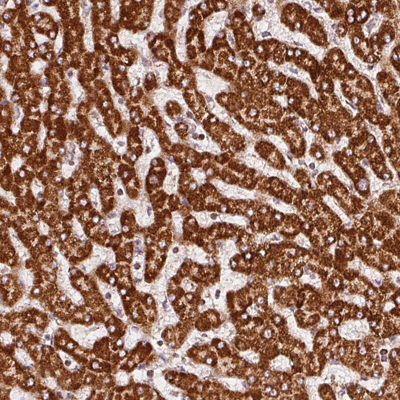 SDHB Antibody (CL0347) - Azide and BSA Free Immunohistochemistry-Paraffin: SDHB Antibody [NBP3-43915]