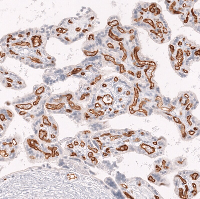 CD34 Antibody (CL14579) - Azide and BSA Free Immunohistochemistry-Paraffin: CD34 Antibody [NBP3-43916]