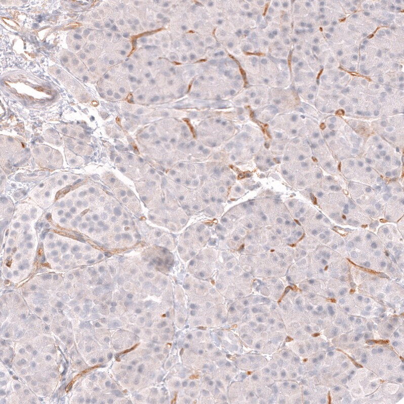 CD34 Antibody (CL14579) - Azide and BSA Free Immunohistochemistry-Paraffin: CD34 Antibody [NBP3-43916]