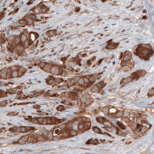Hsp70 interacting protein HIP Antibody (CL3708) - Azide and BSA Free Immunohistochemistry-Paraffin: Hsp70 interacting protein HIP Antibody [NBP3-43918]