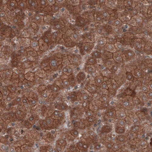 Hsp70 interacting protein HIP Antibody (CL3708) - Azide and BSA Free Immunohistochemistry-Paraffin: Hsp70 interacting protein HIP Antibody [NBP3-43918]