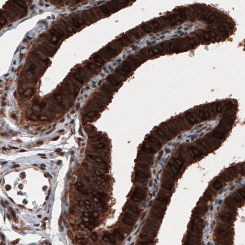 Hsp70 interacting protein HIP Antibody (CL3708) - Azide and BSA Free Immunohistochemistry-Paraffin: Hsp70 interacting protein HIP Antibody [NBP3-43918]