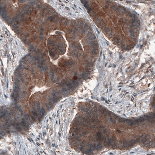Hsp70 interacting protein HIP Antibody (CL3708) - Azide and BSA Free Immunohistochemistry-Paraffin: Hsp70 interacting protein HIP Antibody [NBP3-43918]
