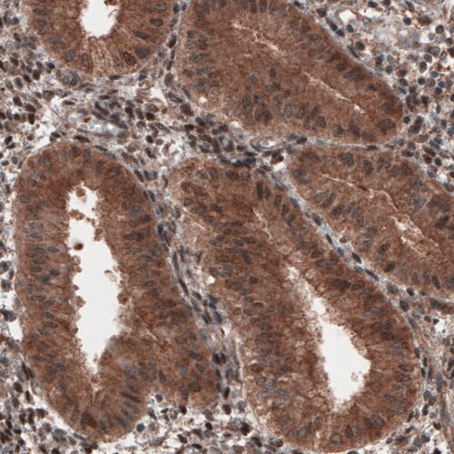 Hsp70 interacting protein HIP Antibody (CL3708) - Azide and BSA Free Immunohistochemistry-Paraffin: Hsp70 interacting protein HIP Antibody [NBP3-43918]
