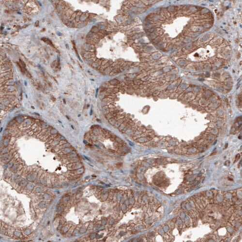 Hsp70 interacting protein HIP Antibody (CL3708) - Azide and BSA Free Immunohistochemistry-Paraffin: Hsp70 interacting protein HIP Antibody [NBP3-43918]