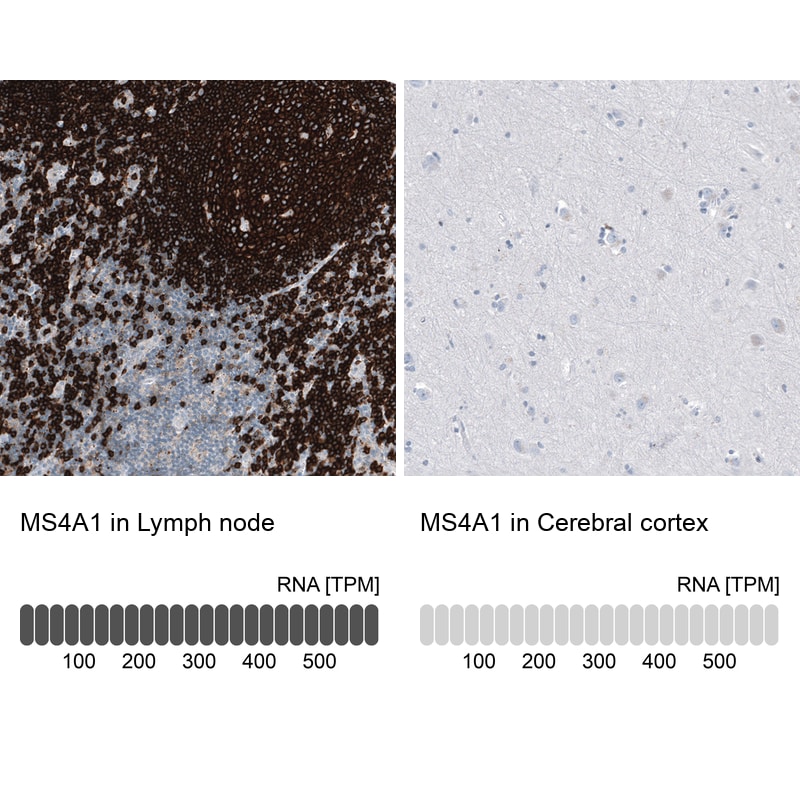 CD20 Antibody (CL10613) - Azide and BSA Free Immunohistochemistry-Paraffin: CD20 Antibody [NBP3-43919]