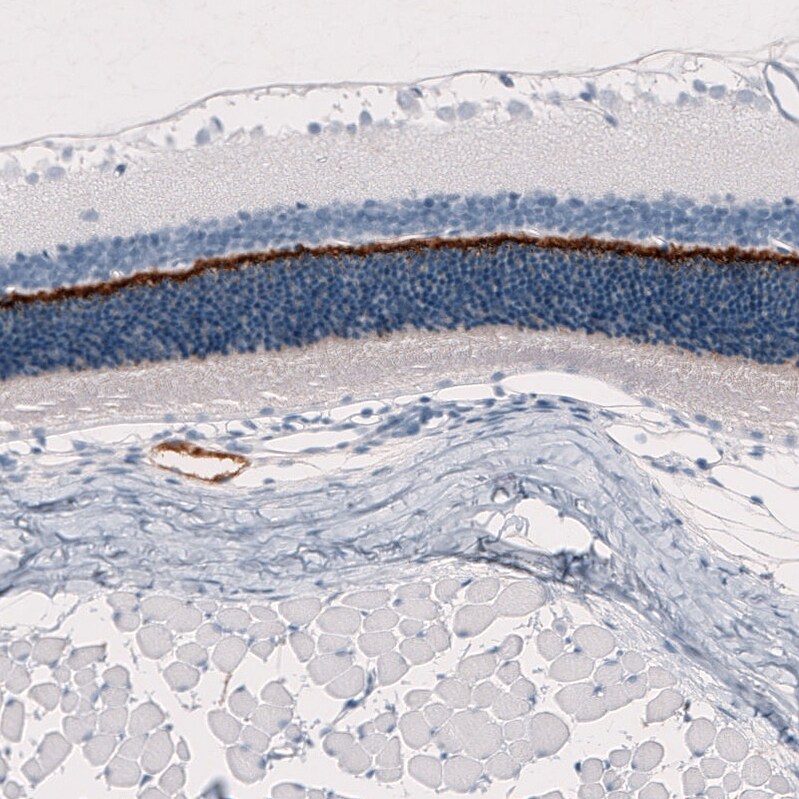 ANO2 Antibody (CL10632) - Azide and BSA Free Immunohistochemistry-Paraffin: ANO2 Antibody [NBP3-43920]