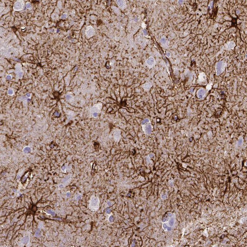 SLC22A2/OCT2 Antibody (CL0628) - Azide and BSA Free Immunohistochemistry-Paraffin: SLC22A2/OCT2 Antibody [NBP3-43921]