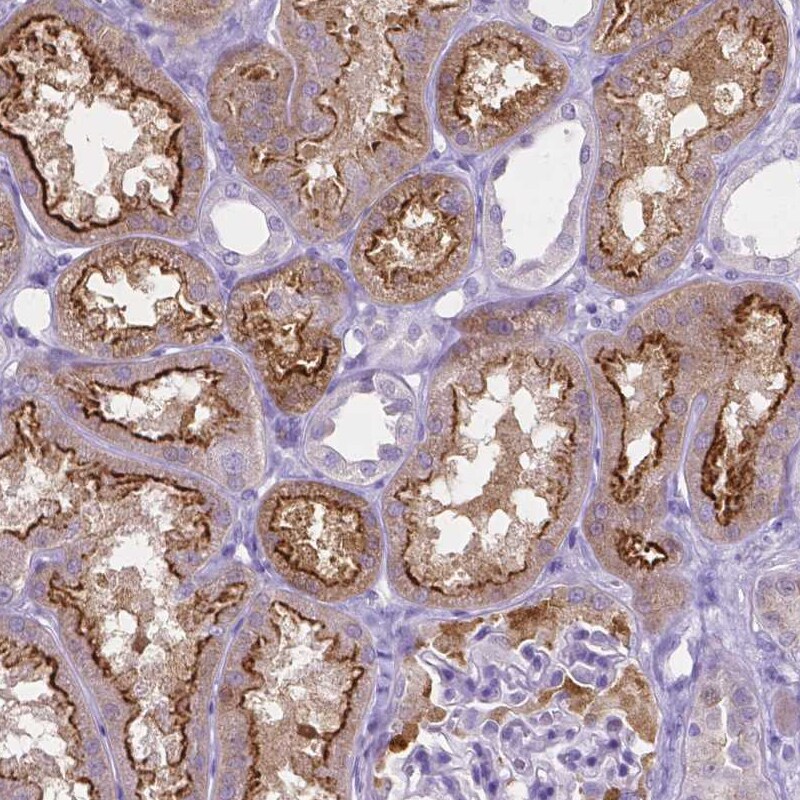 SLC22A2/OCT2 Antibody (CL0628) - Azide and BSA Free Immunohistochemistry-Paraffin: SLC22A2/OCT2 Antibody [NBP3-43921]