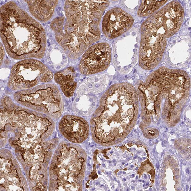 SLC22A2/OCT2 Antibody (CL0631) - Azide and BSA Free Immunohistochemistry-Paraffin: SLC22A2/OCT2 Antibody [NBP3-43922]