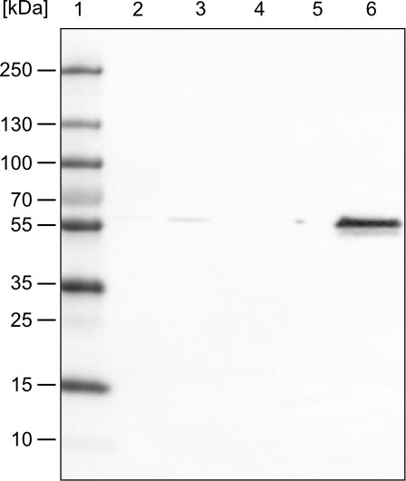 Vimentin Antibody (CL0157) - Azide and BSA Free Western Blot: Vimentin Antibody [NBP3-43924]
