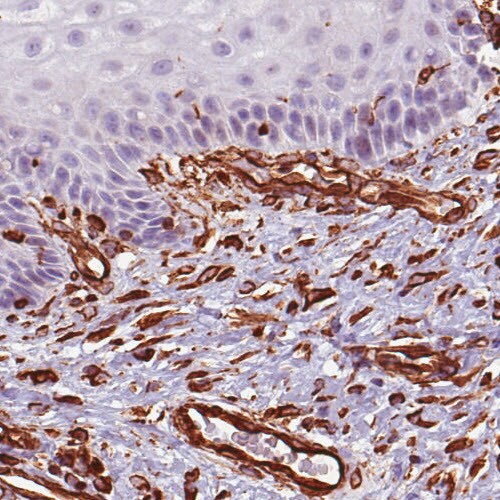 Vimentin Antibody (CL0157) - Azide and BSA Free Immunohistochemistry-Paraffin: Vimentin Antibody [NBP3-43924]