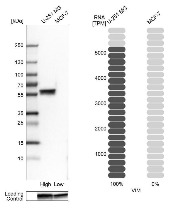 Vimentin Antibody (CL0157) - Azide and BSA Free Western Blot: Vimentin Antibody [NBP3-43924]