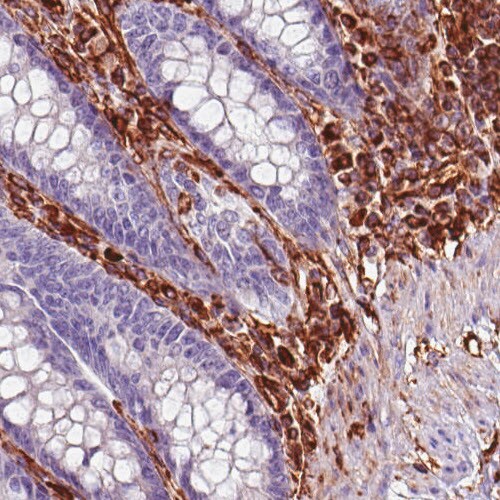 Vimentin Antibody (CL0157) - Azide and BSA Free Immunohistochemistry-Paraffin: Vimentin Antibody [NBP3-43924]
