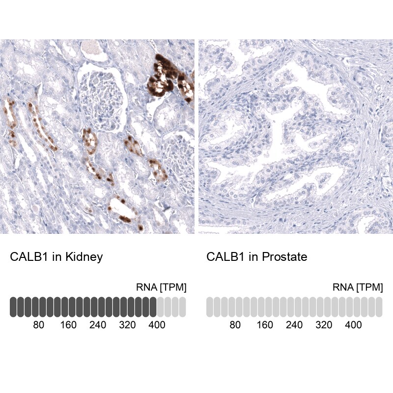 Calbindin D-28K Antibody (CL15065) - Azide and BSA Free Immunohistochemistry-Paraffin: Calbindin D-28K Antibody [NBP3-43925]