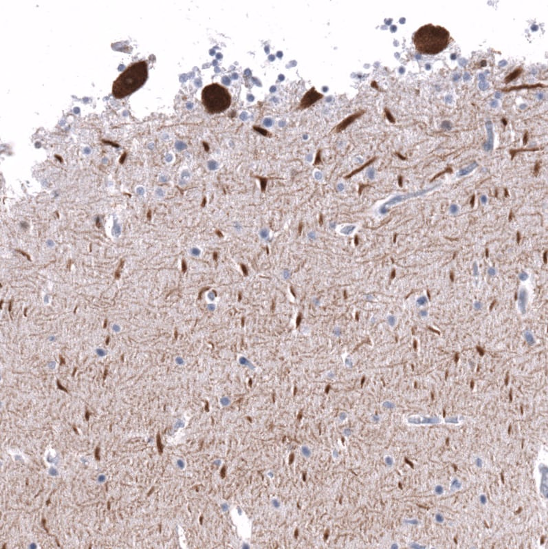 Calbindin D-28K Antibody (CL15065) - Azide and BSA Free Immunohistochemistry-Paraffin: Calbindin D-28K Antibody [NBP3-43925]
