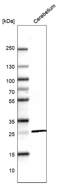 Calbindin D-28K Antibody (CL15065) - Azide and BSA Free Western Blot: Calbindin D-28K Antibody [NBP3-43925]